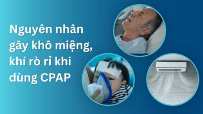 Nguyên nhân gây khô miệng và khí rò rỉ khi dùng máy CPAP