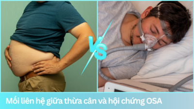 Mối liên hệ giữa thừa cân và hội chứng OSA