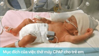 Mục đích của việc thở máy CPAP cho trẻ em