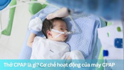 Thở CPAP là gì? Cơ chế hoạt động của máy CPAP
