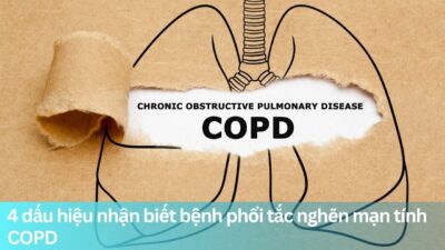 4 dấu hiệu nhận biết bệnh phổi tắc nghẽn mạn tính COPD