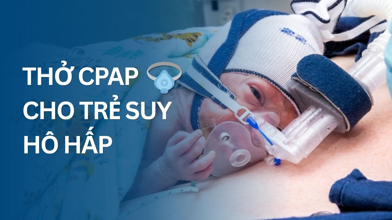 Thở CPAP cho trẻ suy hô hấp