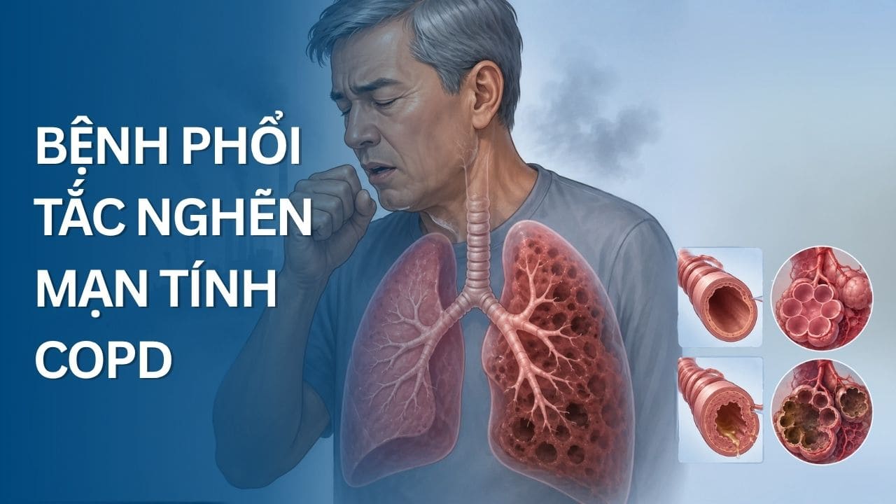 Bệnh phổi tắc nghẽn mạn tính COPD là gì?
